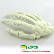 GROSSHANDEL SIMULATION KNOCHEN 12324 Medizinische Künstliche Hand Knochenmodell, Orthopädie Praxis Simulation Knochen